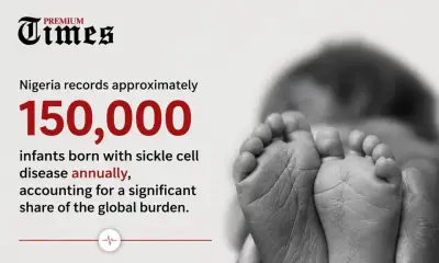 Nigeria's Sickle Cell Burden: 150,000 Newborns Yearly Amid Gaps in Care