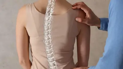 Scoliosis Foundation, Gbagada Hospital train teachers, health workers on early detection