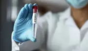 LAWMA Issues Ebola Preparedness Advisory to Health Facilities in Lagos