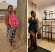Nigerian woman’s remarkable transformation after Bell’s palsy, hypertension