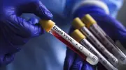 WHO Accelerates Ebola Response, Consults Experts on Vaccines and Treatments