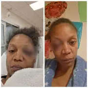 Woman accuses husband of fracturing her face in domestic assault