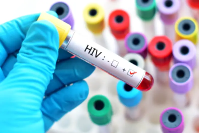 NMA Chair Challenges Interpretation of Lagos HIV Figures