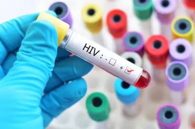 NMA Chair Challenges Interpretation of Lagos HIV Figures